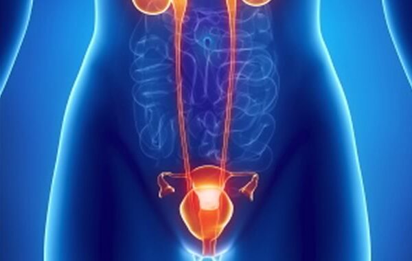 Mesane Kanseri Bulaşır Mı?