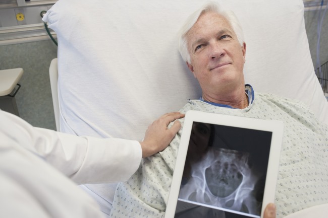 Mesane Kanseri Tedavi Edilmezse Ne Olur?