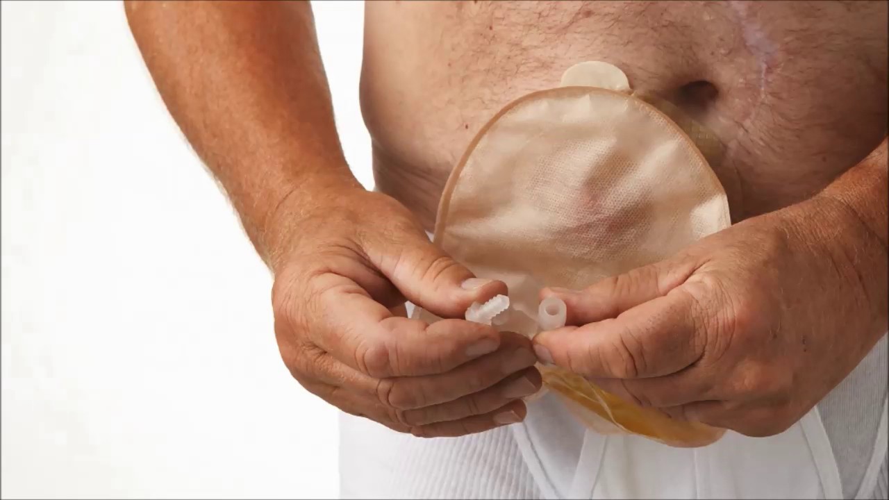 Yapay Mesanenin Dezavantajları