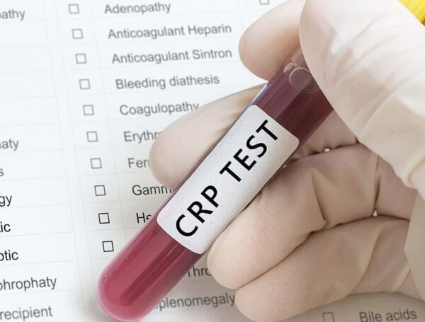 Mesane Kanserinde CRP Yükselir Mi?