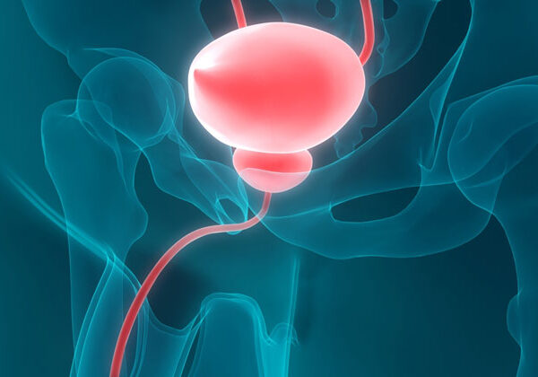 Yapay Mesane Ameliyatı Fiyatı