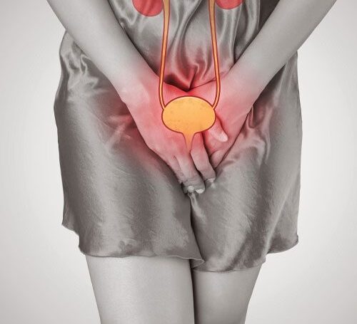 Mesane Kanseri Kaç Yaşında Görülür?