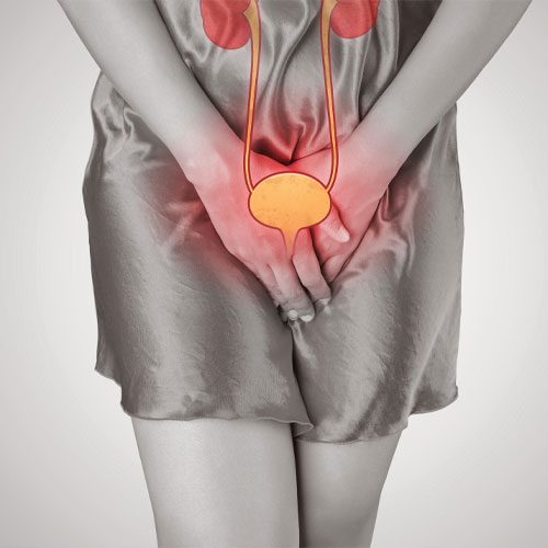 Mesane Kanseri Kaç Yaşında Görülür?