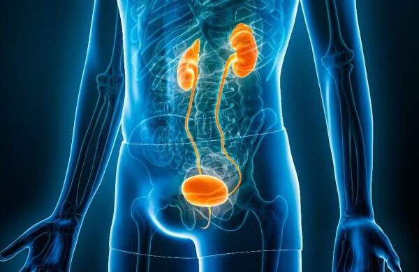 Mesane Kanserinin Kesin Tedavisi Var Mı?