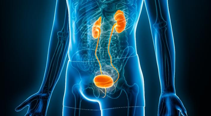 Mesane Kanserinin Kesin Tedavisi Var Mı?