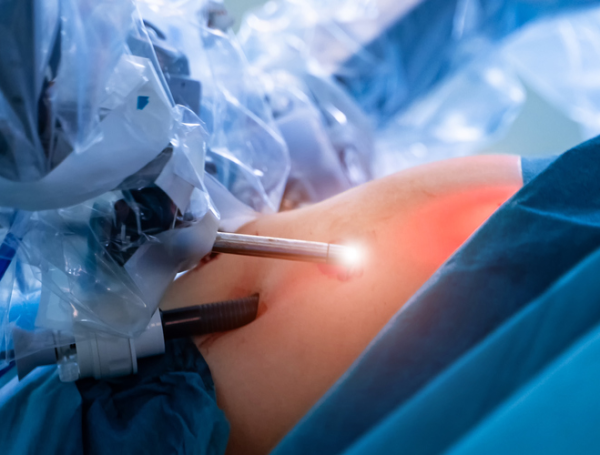 Robotik Cerrahi ile Mesane Kanseri Ameliyatı Avantajları