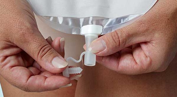 Mesane Alındıktan Sonra Torba