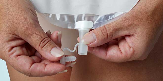 Mesane Alındıktan Sonra Torba