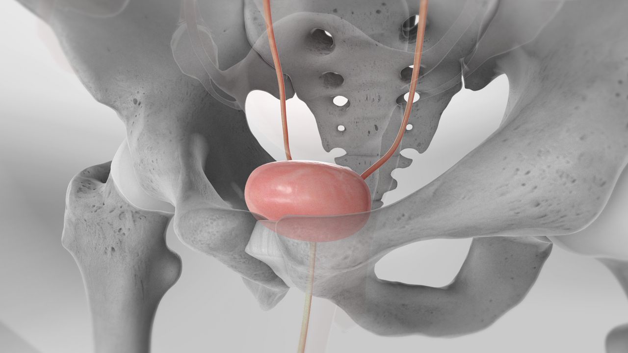 Mesane Alınması Ameliyatı (Sistektomi)