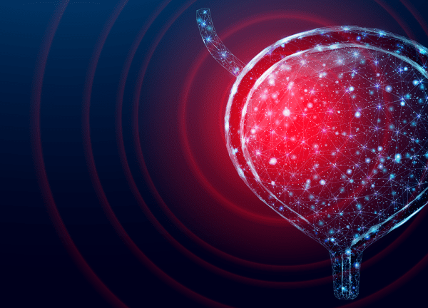 Mesane Kanserinin Evreye Göre Tedavisi