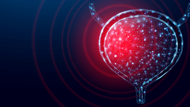 Mesane Kanserinin Evreye Göre Tedavisi