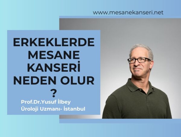 Erkeklerde Mesane Kanseri Neden Olur?