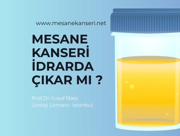 Mesane Kanseri İdrarda Çıkar mı?