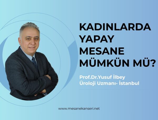 Kadınlarda Yapay Mesane Mümkün mü?